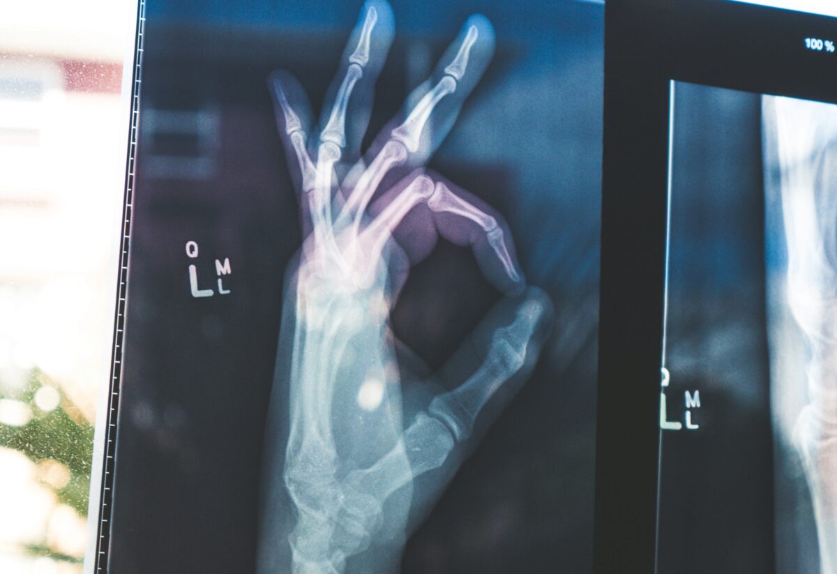 xray of a hand