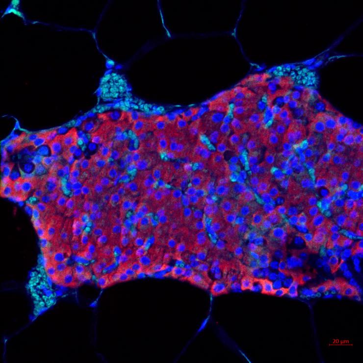 Garcia research transplanted islet cells