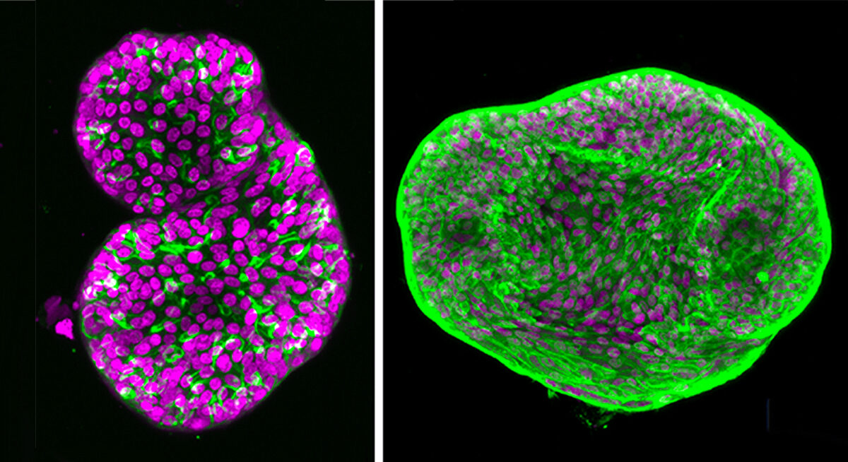 Two organoids