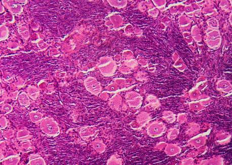 Organoids